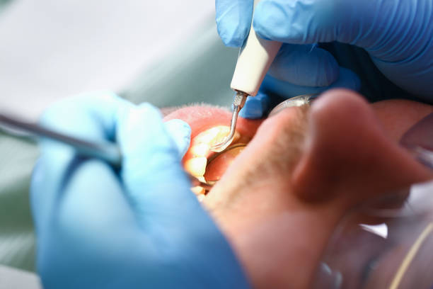 Best Emergency Dental Care for Trauma or Injury in Marion, SC