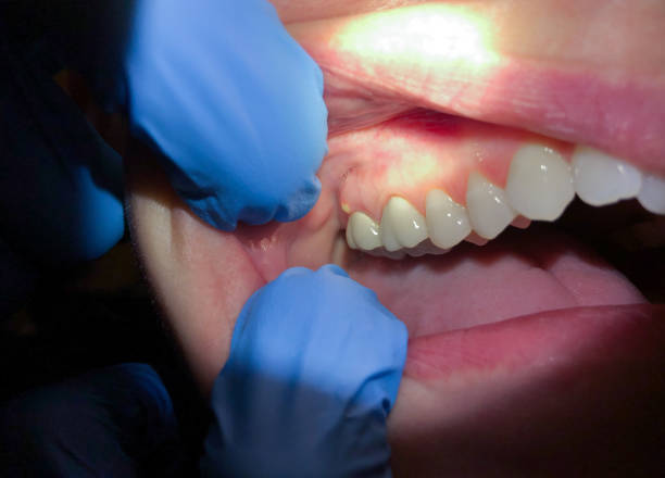 Best Urgent Dental Care in Marion, SC