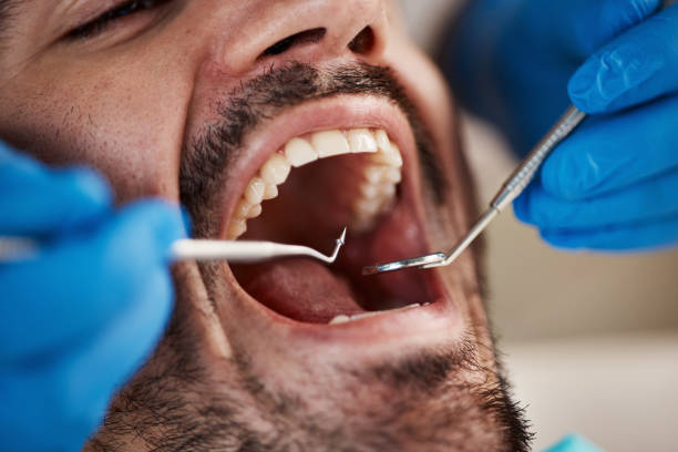 Best Same-Day Emergency Dentist in Marion, SC