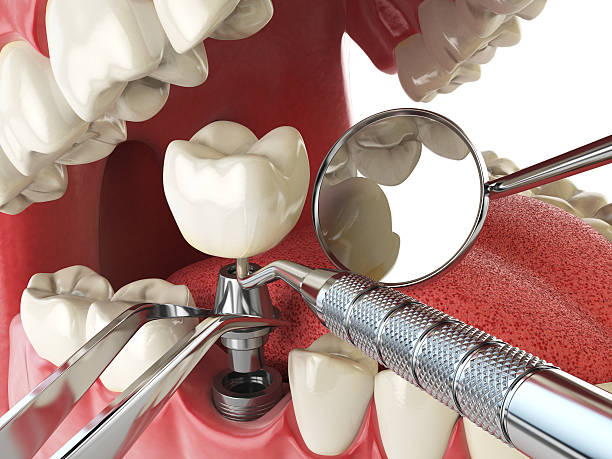 Best Pediatric Emergency Dentist in Marion, SC