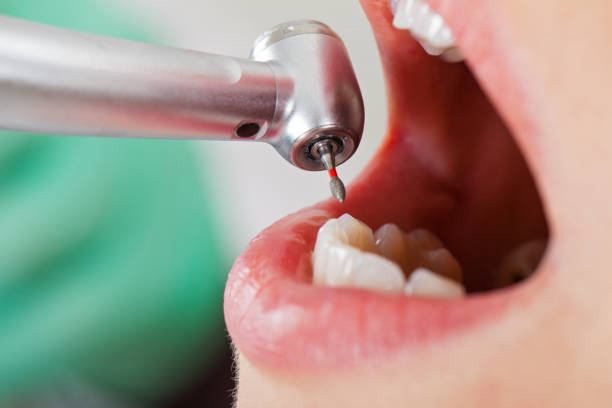 Best Emergency Broken Tooth Repair in Marion, SC